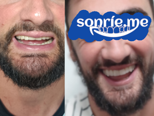 Miguel: denti consumati e corti